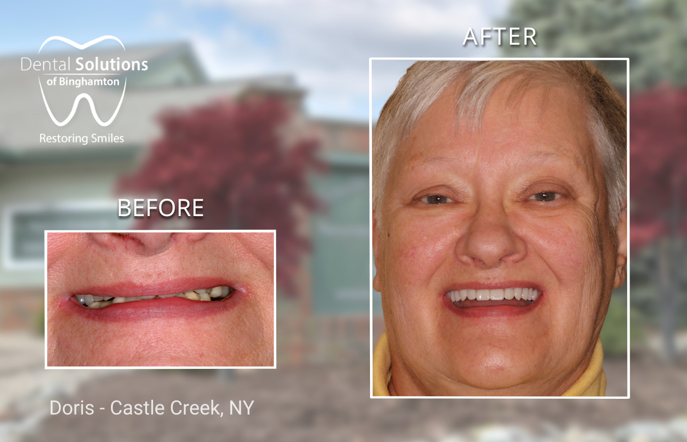 Doris - Castle Creek, NY