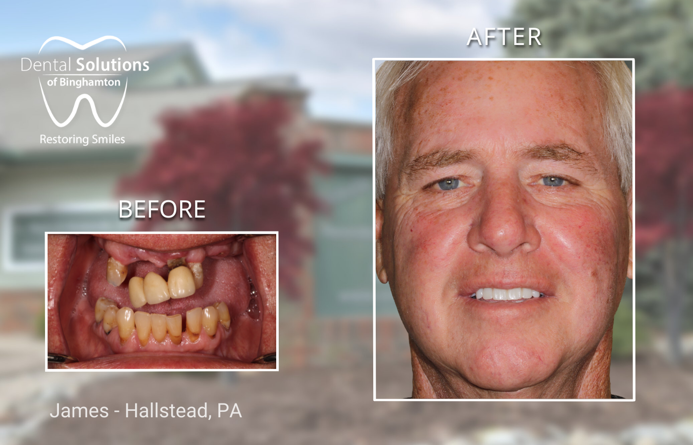 James - Hallstead, PA